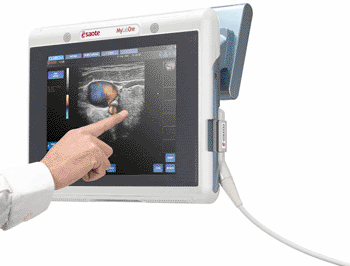 Image: The MyLabOne Vascular tablet-size ultrasound (Photo courtesy of Esaote).